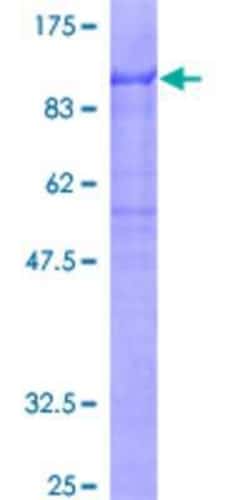 Novus Biologicals Recombinant Human ZKSCAN1 GST (N-Term) Protein 25 &mu;g | Buy Online | Novus Biologicals&trade; | Fisher Scientific