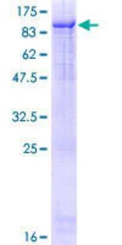 Novus Biologicals Recombinant Human ZKSCAN1 GST (N-Term) Protein 10 &mu;g | Buy Online | Novus Biologicals&trade; | Fisher Scientific