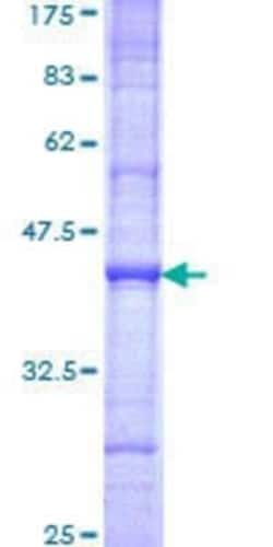 Novus Biologicals Recombinant Human ZNF37A GST (N-Term) Protein 10 &mu;g | Buy Online | Novus Biologicals&trade; | Fisher Scientific