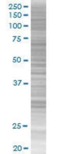Novus Biologicals ZNF37A 293T Cell Transient Overexpression Lysate 0.1 mL | Buy Online | Novus Biologicals&trade; | Fisher Scientific