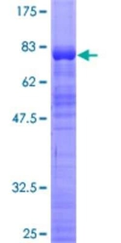 Novus Biologicals Recombinant Human ZSCAN21/ZFP38 GST (N-Term) Protein 2 &mu;g | Buy Online | Novus Biologicals&trade; | Fisher Scientific