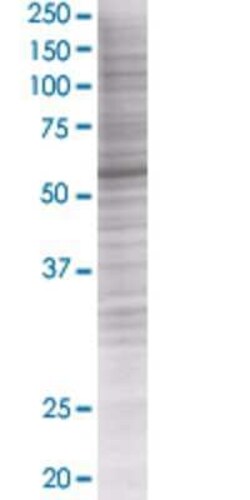 Novus Biologicals ZSCAN21/ZFP38 293T Cell Transient Overexpression Lysate 0.1 mL | Buy Online | Novus Biologicals&trade; | Fisher Scientific