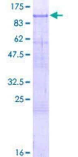 Novus Biologicals Recombinant Human ZNF41 GST (N-Term) Protein 2 &mu;g | Buy Online | Novus Biologicals&trade; | Fisher Scientific