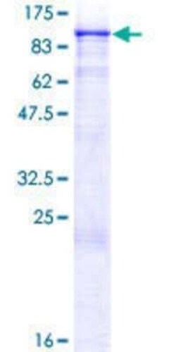Novus Biologicals Recombinant Human MZF1 GST (N-Term) Protein 2 &mu;g | Buy Online | Novus Biologicals&trade; | Fisher Scientific
