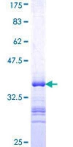 Novus Biologicals Recombinant Human MZF1 GST (N-Term) Protein 10 &mu;g | Buy Online | Novus Biologicals&trade; | Fisher Scientific