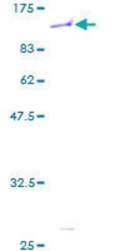 Novus Biologicals Recombinant Human ZNF45 GST (N-Term) Protein 2 &mu;g | Buy Online | Novus Biologicals&trade; | Fisher Scientific
