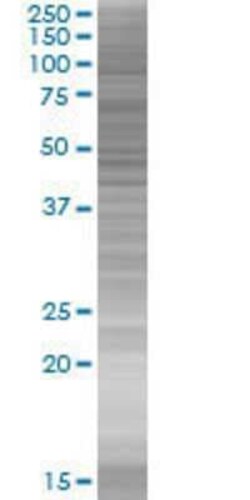 Novus Biologicals&trade;&nbsp;ZBTB25 293T Cell Transient Overexpression Lysate