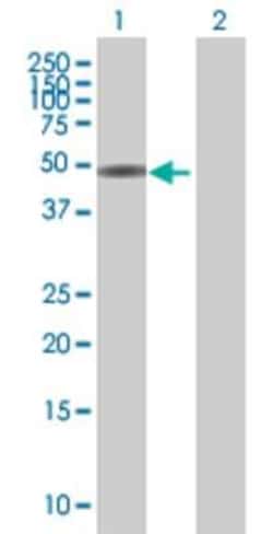 Novus Biologicals ZBTB25 293T Cell Transient Overexpression Lysate 0.1 mL | Buy Online | Novus Biologicals&trade; | Fisher Scientific