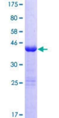 Novus Biologicals Recombinant Human ZNF69 GST (N-Term) Protein 25 &mu;g | Buy Online | Novus Biologicals&trade; | Fisher Scientific