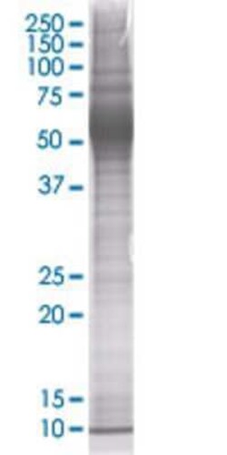 Novus Biologicals ZNF70 293T Cell Transient Overexpression Lysate 0.1 mL | Buy Online | Novus Biologicals&trade; | Fisher Scientific