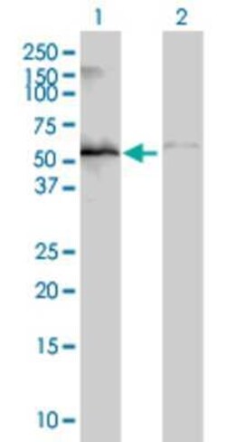 Novus Biologicals ZNF70 293T Cell Transient Overexpression Lysate 0.1 mL | Buy Online | Novus Biologicals&trade; | Fisher Scientific