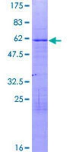 Novus Biologicals Recombinant Human ZNF75A GST (N-Term) Protein 10 &mu;g | Buy Online | Novus Biologicals&trade; | Fisher Scientific