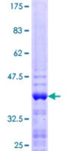 Novus Biologicals Recombinant Human ZNF75A GST (N-Term) Protein 25 &mu;g | Buy Online | Novus Biologicals&trade; | Fisher Scientific