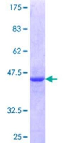 Novus Biologicals Recombinant Human ZNF76 GST (N-Term) Protein 10 &mu;g | Buy Online | Novus Biologicals&trade; | Fisher Scientific