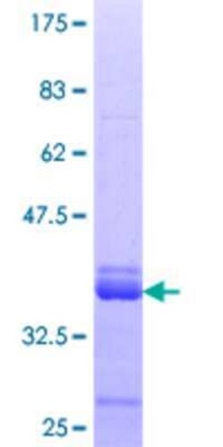 Novus Biologicals Recombinant Human ZNF79 GST (N-Term) Protein 10 &mu;g | Buy Online | Novus Biologicals&trade; | Fisher Scientific