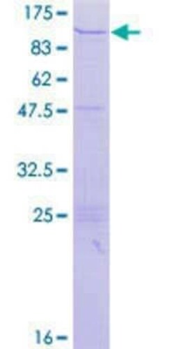 Novus Biologicals Recombinant Human ZNF84 GST (N-Term) Protein 10 &mu;g | Buy Online | Novus Biologicals&trade; | Fisher Scientific