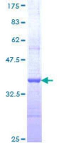 Novus Biologicals Recombinant Human ZNF85 GST (N-Term) Protein 25 &mu;g | Buy Online | Novus Biologicals&trade; | Fisher Scientific