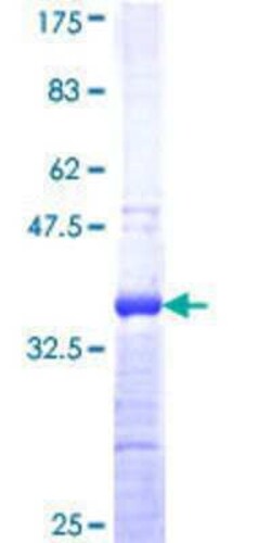 Novus Biologicals Recombinant Human ZNF124 GST (N-Term) Protein 25 &mu;g | Buy Online | Novus Biologicals&trade; | Fisher Scientific