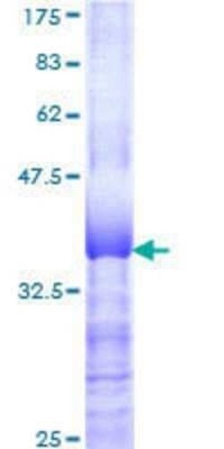 Novus Biologicals Recombinant Human ZNF131 GST (N-Term) Protein 25 &mu;g | Buy Online | Novus Biologicals&trade; | Fisher Scientific