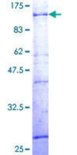 Novus Biologicals Recombinant Human ZNF133 GST (N-Term) Protein 25 &mu;g | Buy Online | Novus Biologicals&trade; | Fisher Scientific