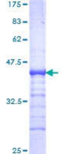 Novus Biologicals Recombinant Human ZNF133 GST (N-Term) Protein 25 &mu;g | Buy Online | Novus Biologicals&trade; | Fisher Scientific