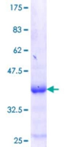 Novus Biologicals Recombinant Human ZNF134 GST (N-Term) Protein 25 &mu;g | Buy Online | Novus Biologicals&trade; | Fisher Scientific