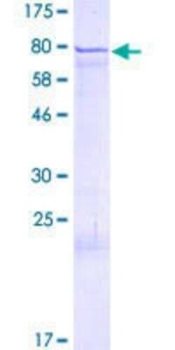 Novus Biologicals Recombinant Human ZNF136 GST (N-Term) Protein 2 &mu;g | Buy Online | Novus Biologicals&trade; | Fisher Scientific