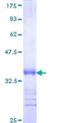 Novus Biologicals Recombinant Human ZNF136 GST (N-Term) Protein 10 &mu;g | Buy Online | Novus Biologicals&trade; | Fisher Scientific