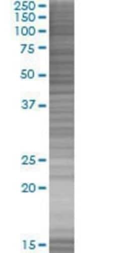 Novus Biologicals ZNF136 293T Cell Transient Overexpression Lysate 0.1 mL | Buy Online | Novus Biologicals&trade; | Fisher Scientific