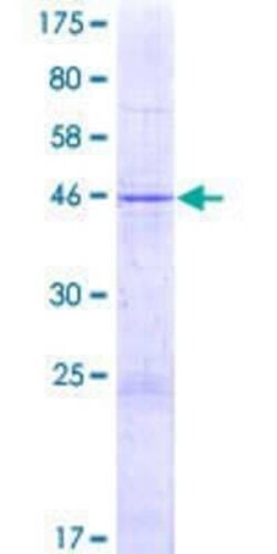 Novus Biologicals Recombinant Human ZNF137 GST (N-Term) Protein 2 &mu;g | Buy Online | Novus Biologicals&trade; | Fisher Scientific
