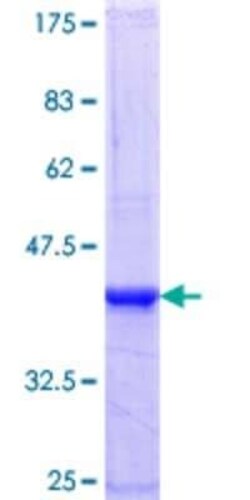 Novus Biologicals Recombinant Human ZNF137 GST (N-Term) Protein 25 &mu;g | Buy Online | Novus Biologicals&trade; | Fisher Scientific
