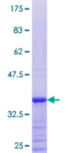 Novus Biologicals Recombinant Human ZNF138 GST (N-Term) Protein 25 &mu;g | Buy Online | Novus Biologicals&trade; | Fisher Scientific