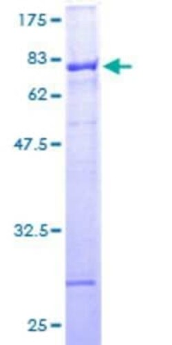 Novus Biologicals Recombinant Human ZNF140 GST (N-Term) Protein 10 &mu;g | Buy Online | Novus Biologicals&trade; | Fisher Scientific