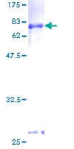 Novus Biologicals Recombinant Human MEL-18 GST (N-Term) Protein 10 &mu;g | Buy Online | Novus Biologicals&trade; | Fisher Scientific