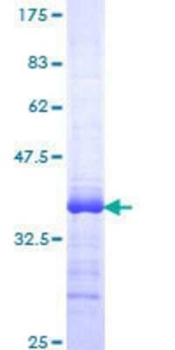 Novus Biologicals Recombinant Human PLZF GST (N-Term) Protein 25 &mu;g | Buy Online | Novus Biologicals&trade; | Fisher Scientific
