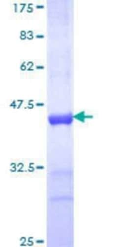 Novus Biologicals Recombinant Human TRIM25 GST (N-Term) Protein 10 &mu;g | Buy Online | Novus Biologicals&trade; | Fisher Scientific