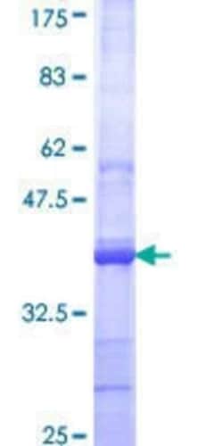 Novus Biologicals Recombinant Human ZNF154 GST (N-Term) Protein 25 &mu;g | Buy Online | Novus Biologicals&trade; | Fisher Scientific