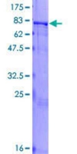 Novus Biologicals Recombinant Human ZNF155 GST (N-Term) Protein 25 &mu;g | Buy Online | Novus Biologicals&trade; | Fisher Scientific