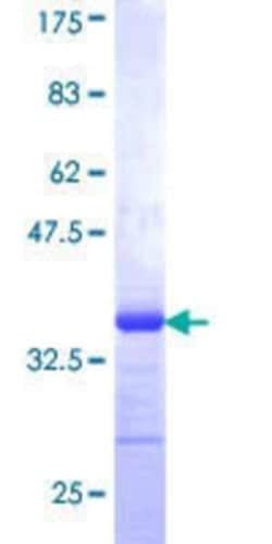 Novus Biologicals Recombinant Human ZNF155 GST (N-Term) Protein 10 &mu;g | Buy Online | Novus Biologicals&trade; | Fisher Scientific