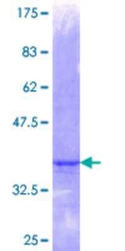 Novus Biologicals Recombinant Human ZNF157 GST (N-Term) Protein 25 &mu;g | Buy Online | Novus Biologicals&trade; | Fisher Scientific