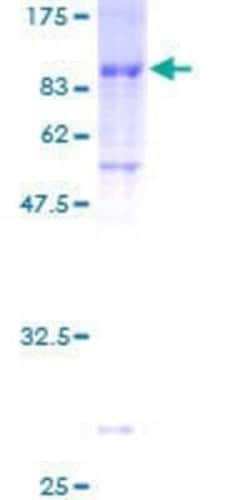 Novus Biologicals Recombinant Human ZNF165 GST (N-Term) Protein 25 &mu;g | Buy Online | Novus Biologicals&trade; | Fisher Scientific