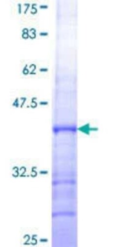 Novus Biologicals Recombinant Human TRIM26 GST (N-Term) Protein 25 &mu;g | Buy Online | Novus Biologicals&trade; | Fisher Scientific