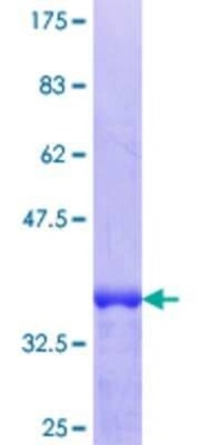 Novus Biologicals Recombinant Human TRIM26 GST (N-Term) Protein 25 &mu;g | Buy Online | Novus Biologicals&trade; | Fisher Scientific
