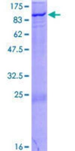 Novus Biologicals Recombinant Human ZNF175 GST (N-Term) Protein 25 &mu;g | Buy Online | Novus Biologicals&trade; | Fisher Scientific