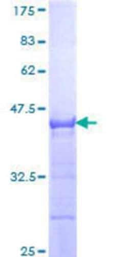 Novus Biologicals Recombinant Human ZNF175 GST (N-Term) Protein 10 &mu;g | Buy Online | Novus Biologicals&trade; | Fisher Scientific