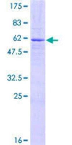 Novus Biologicals Recombinant Human ZNF177 GST (N-Term) Protein 10 &mu;g | Buy Online | Novus Biologicals&trade; | Fisher Scientific