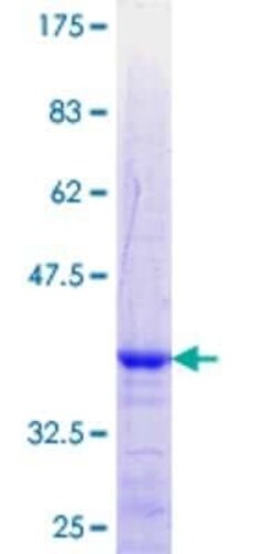 Novus Biologicals Recombinant Human Zinc finger protein 180 GST (N-Term) Protein 25 &mu;g | Buy Online | Novus Biologicals&trade; | Fisher Scientific