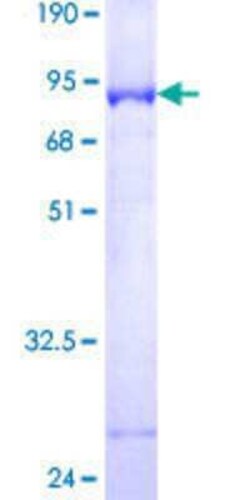 Novus Biologicals Recombinant Human RNF113A GST (N-Term) Protein 25 &mu;g | Buy Online | Novus Biologicals&trade; | Fisher Scientific