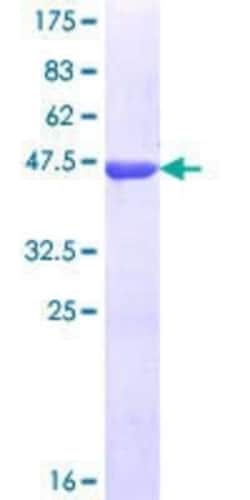 Novus Biologicals Recombinant Human ZNF184 GST (N-Term) Protein 25 &mu;g | Buy Online | Novus Biologicals&trade; | Fisher Scientific