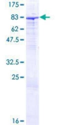 Novus Biologicals Recombinant Human ZNF189 GST (N-Term) Protein 10 &mu;g | Buy Online | Novus Biologicals&trade; | Fisher Scientific